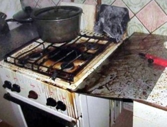 ​В Медногорске при розжиге газовой плиты у женщины обгорело лицо